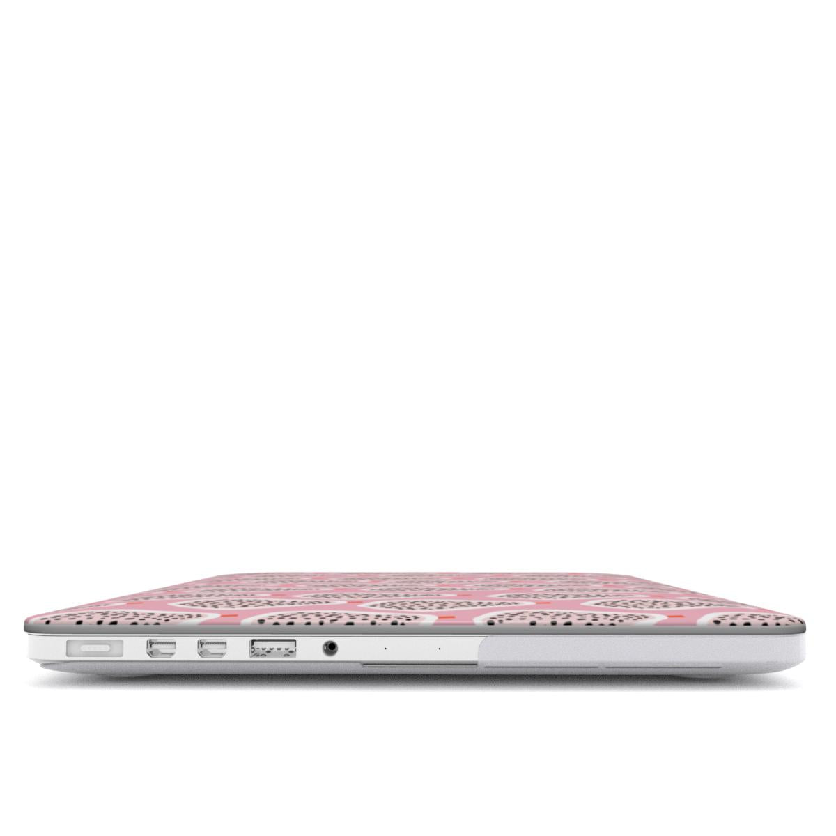 Juicylicious - MacBook Case