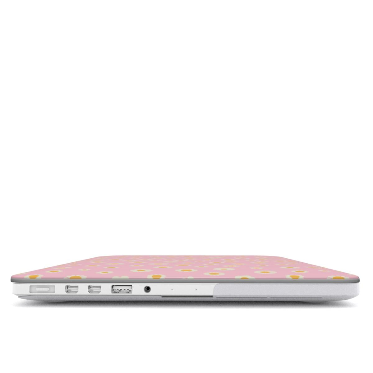 Dayzie - MacBook Case