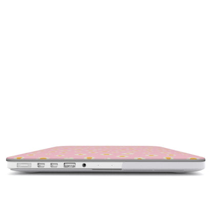 Dayzie - MacBook Case