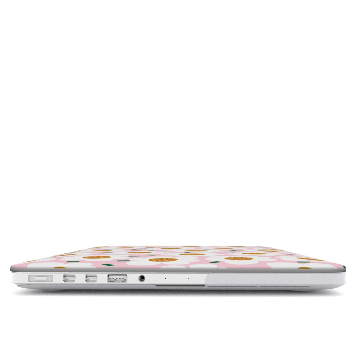 Bloomzy - MacBook Case