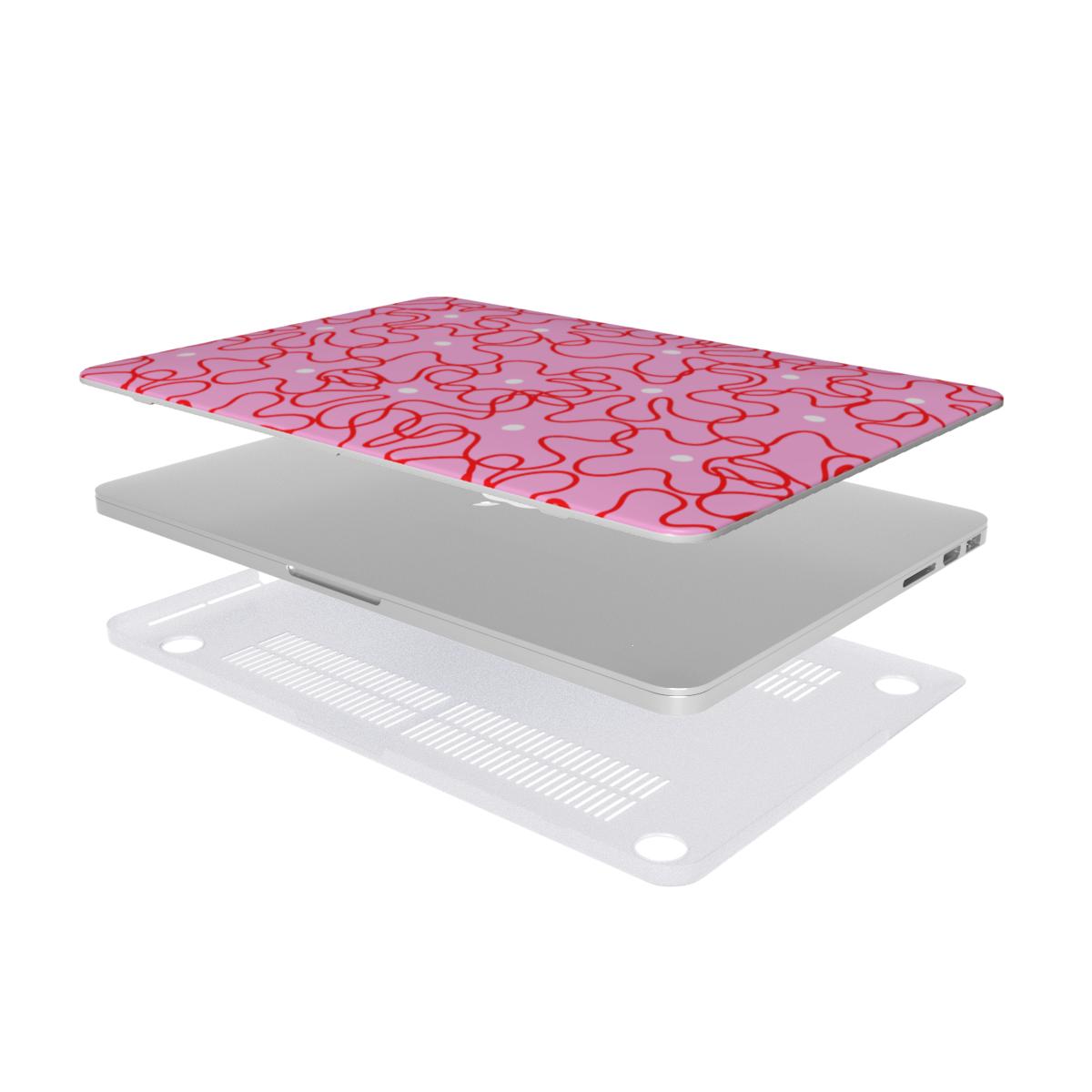 Fizzpop - MacBook Case