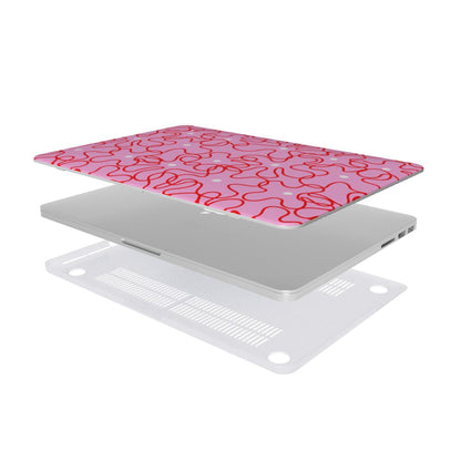 Fizzpop - MacBook Case