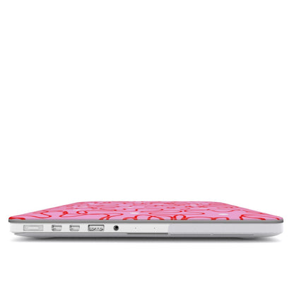 Fizzpop - MacBook Case